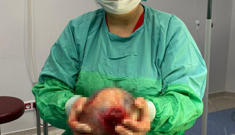 Kasık ağrısıyla hastaneye gitti! Doktorlar bile şaşkına döndü