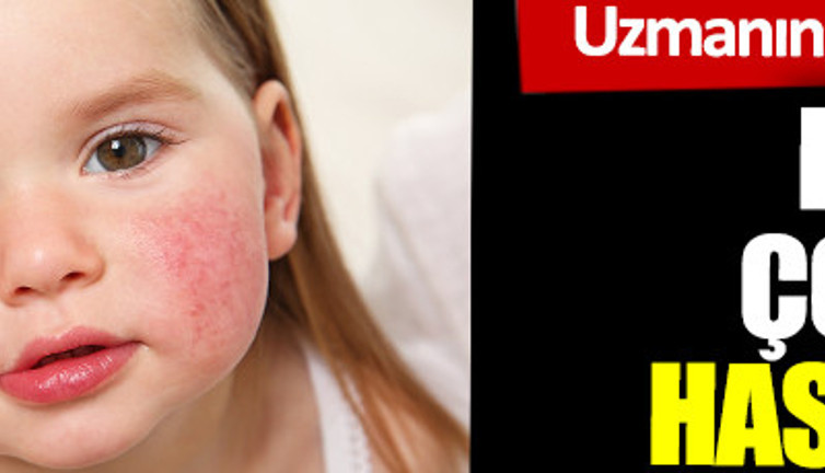 Uzmanından çok önemli uyarı. Bu besinler çocuğunuzu hasta edebilir