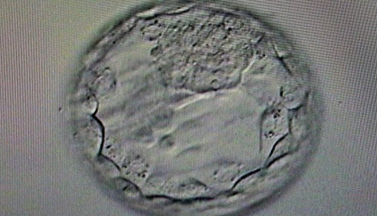 Gebelik yaşı tarihe karıştı. Doç. Dr. Davut Güven müjdeyi verdi