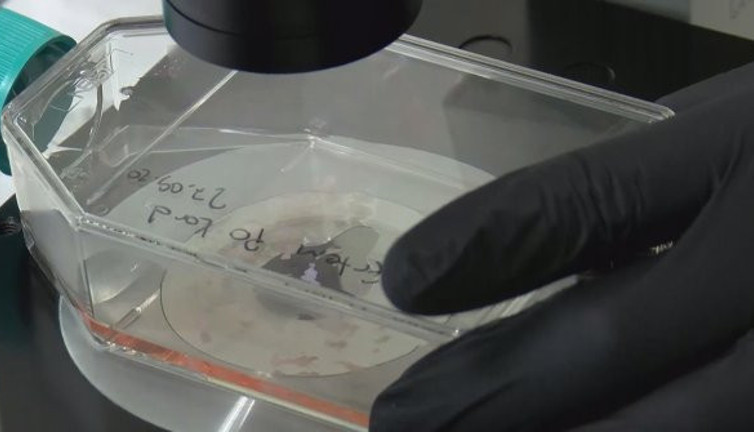 Türkiye'deki korona hastalarını yaşatmanın sırrı çöpte gizli. Ölüm oranı Türkiye'de yarı yarıya düşük diyen Prof. Dr. Gürsel Turgut açıkladı