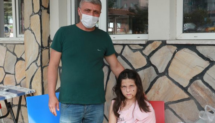 12 yaşındaki kız çocuğunu pitbullar paramparça etti. Geceleri tir tir titriyor