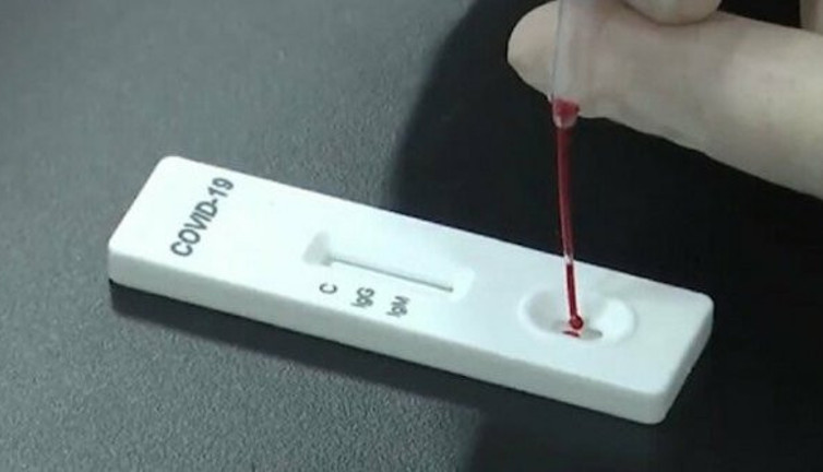 Bilim insanlarından dev buluş. Artık korona hastalığının şiddetini öğrenebileceksiniz