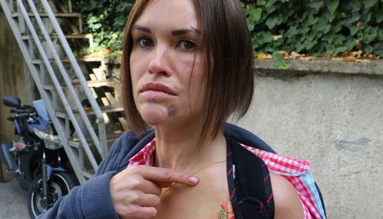 Ankara'da kocası döve döve Rus gelinin kemiklerini kırdı. Uzaklaştırma kararı bile durduramadı