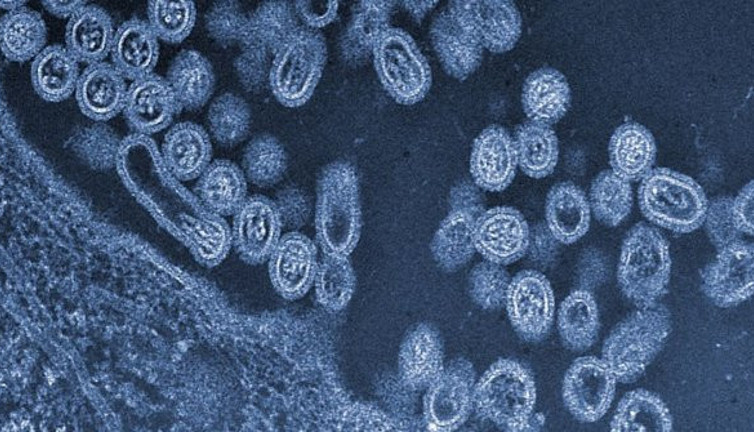 Bilim insanları yeni felaketi böyle duyurdu. Korona bunun yanında hafif kalacak. Tehlikeyi marketlerden eve getiriyoruz