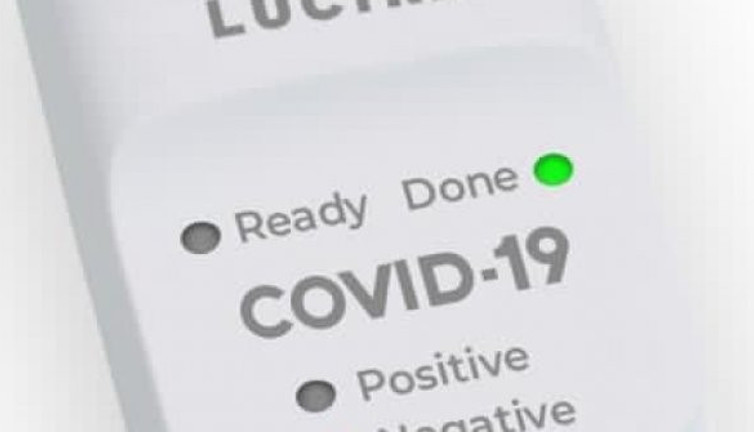 Kendiniz yapıp sonucu 30 dakikada öğreneceksiniz. Hastanelerde dolaşmanıza gerek kalmayacak