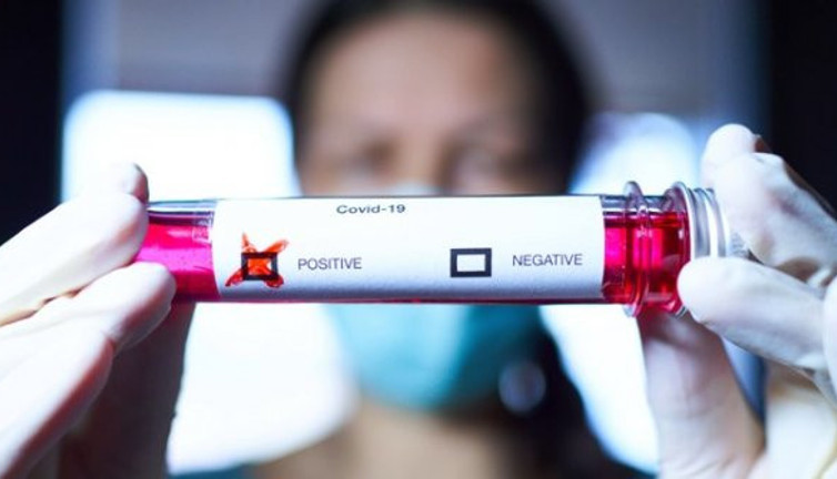 Türkler korona virüste olağan dışı semptomu ortaya çıkardı. Rus, Alman, Çin, ABD aşıyı buldu