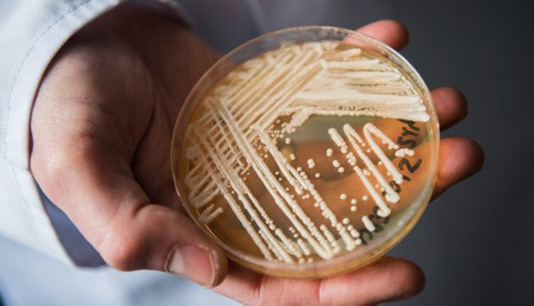 Bilim insanları tedavisi yok ve ölümcül diyerek açıkladı. Yayılmaması için acil çalışma başlatıldı