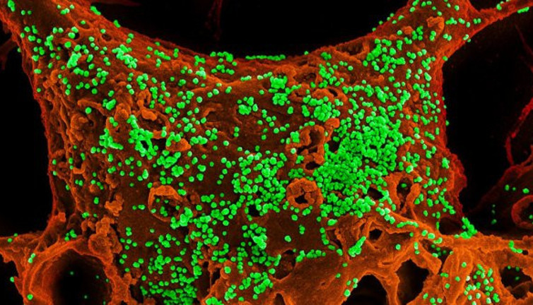 Tüm dünyanın gözü aşıdayken korona tedavisinde ilaç müjdesi geldi. ABD’deki Türk profesör açıkladı. 1 günde iyi ediyor