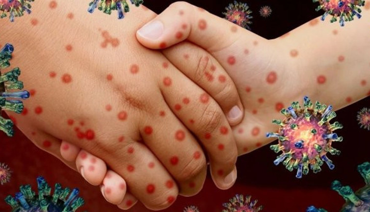 Prof. Dr. Çalışkan tam tarihi verip aşı sıralamasını açıkladı