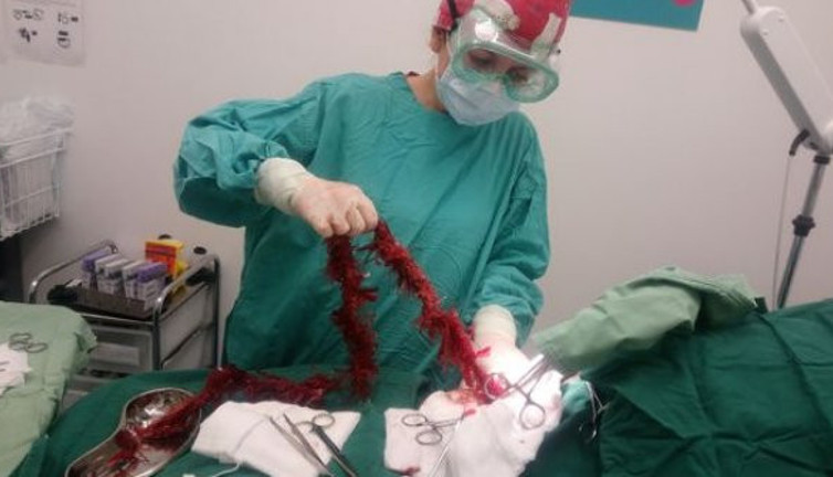 Karnından çıkarılan şey az kalsın öldürüyordu, çek çek sonu gelmedi