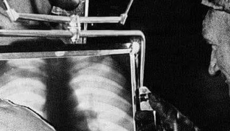 Afrika'da elmas madeninde çalışan işçilerin elmas yutmuş mu diye röntgenini çekiyorlardı. Batı'nın utanç fotoğrafı