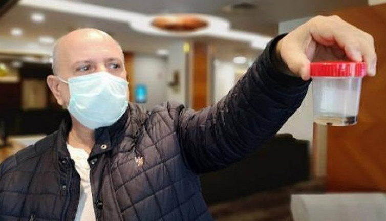 İstanbul'da yaşayan Yusuf Çebi'nin Akciğerinden 32 yıl sonra çam fıstığı çıktı