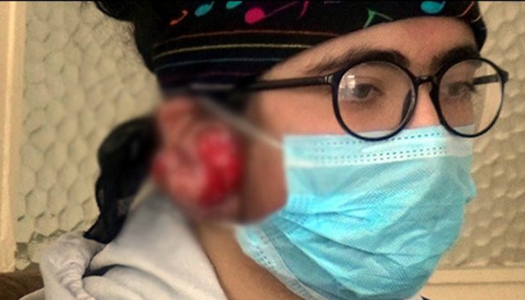 Yağmur Yıldız'ın 7 yaşında taktığı küpeler hayatını kabusa çevirdi. Tedavi olmazsa duyamayacak