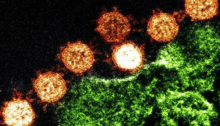 Bilim insanları aman dikkat diyerek açıkladı. Hepimiz içli dışlıydık meğer onlar da korona virüslüymüş