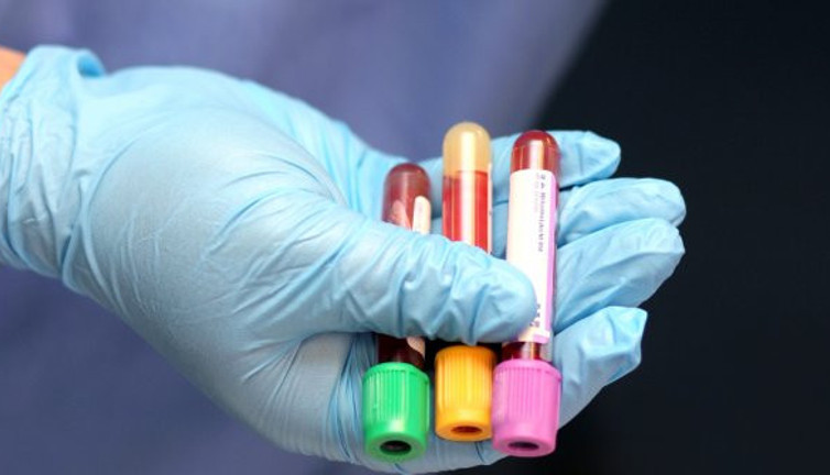 Uzun teşhis dönemi sona eriyor. Artık kan testi ile teşhis edilecek