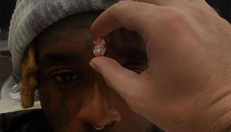 Servetini alnında taşıyor. Ünlü rapçi Lil Uzi Vert, 170 milyon TL’lik elmas taktırdı