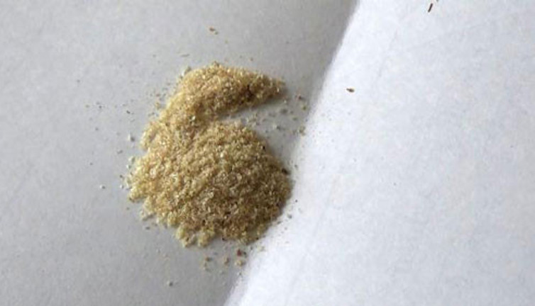 Kanser hücrelerini önce durduruyor sonra öldürüyor. Prof. Dr. Kolaylı açıkladı