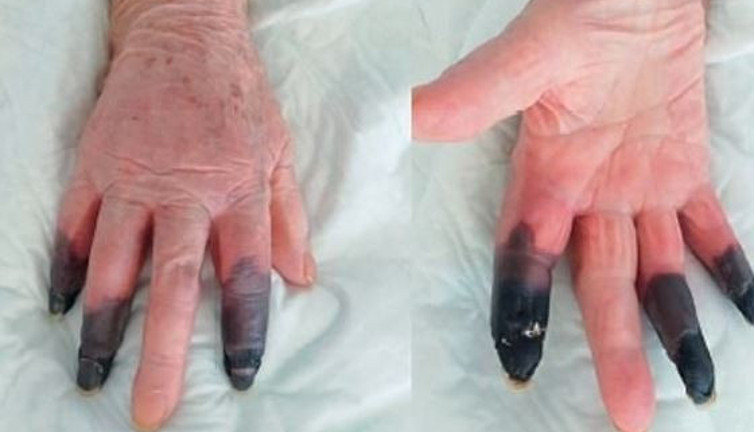 Koronayı atlattım diye sevinme. Başımıza bir de bu geldi