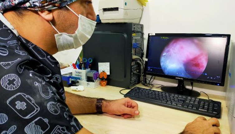 Endoskopi yapan doktor akciğerin içinde gördü gözlerine inanamadı