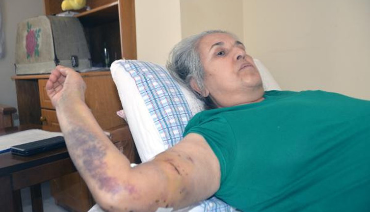 Yürüyüş yapan kadın dehşeti yaşadı. 5'i aynı anda saldırıya geçti.