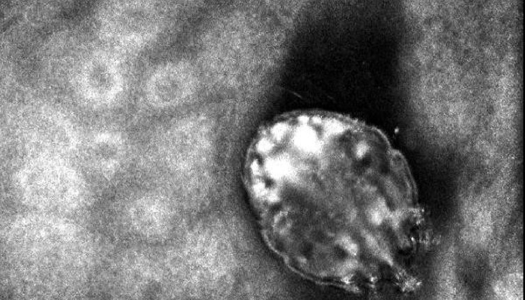 Vücutta yaralar açıyor uykusuz geceler yaşatıyor. İstanbul bu hastalığın pençesinde