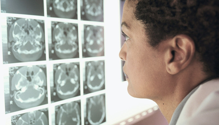 Şimdi de gizemli beyin hastalığı patladı. Bakın nasıl gelişiyor