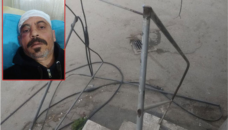 Ölümden şans eseri kurtuldu