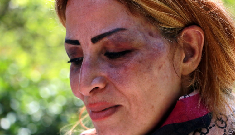 İdamdan kaçan mimara kocası cehennemi yaşattı. Ölmeden mezarını kazdı