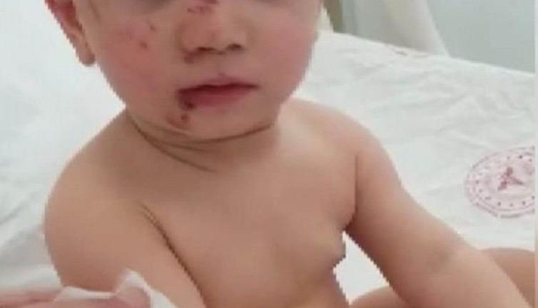 6.kattan düşen 2 yaşındaki çocuk kurtuldu