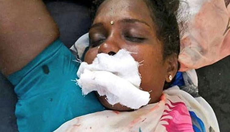 Seçim zaferi genç kadını dilsiz bıraktı. Doktorlardan peş peşe açıklama geldi