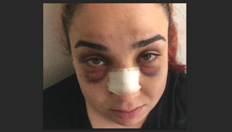 Pastacı kadına süpürgeli dayak