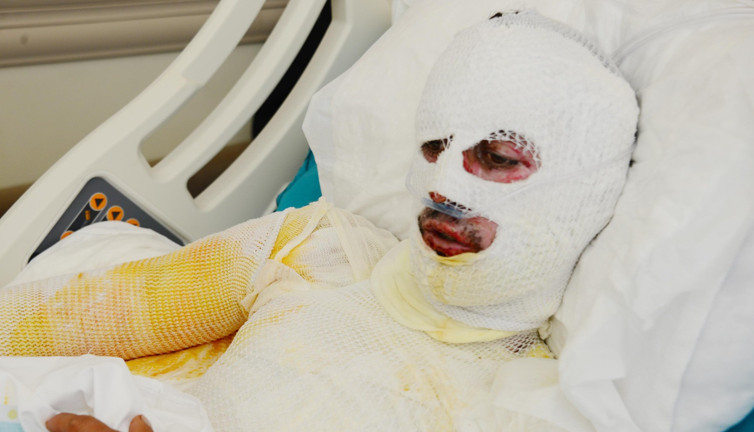 Talihsiz çoban hastanelik oldu