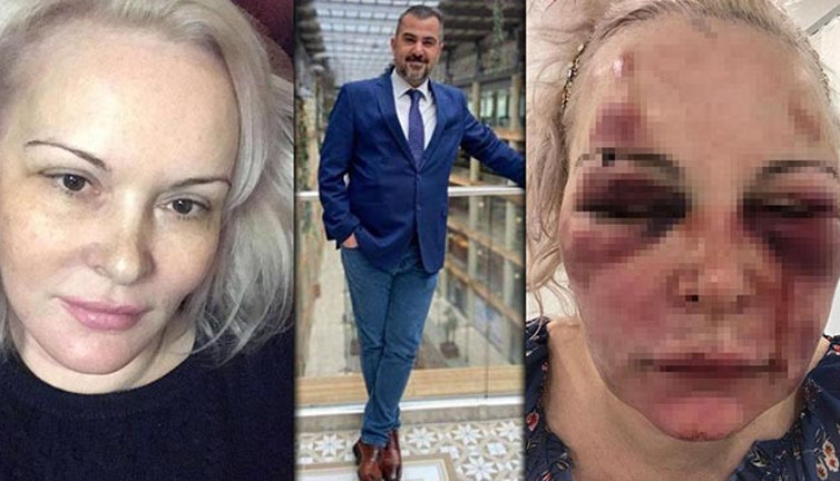 Rus sevgiliye otelde cehennemi yaşattı. Alp Mutlu için istenen ceza belli oldu