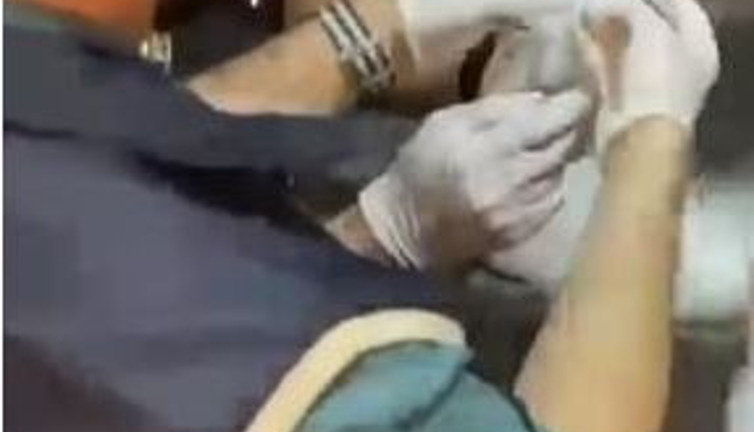 Halüsinasyon gördürüyor derilerini parçalatıyor