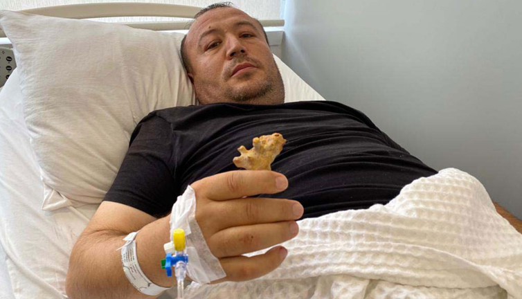 Böbreğinden geyik boynuzu çıktı