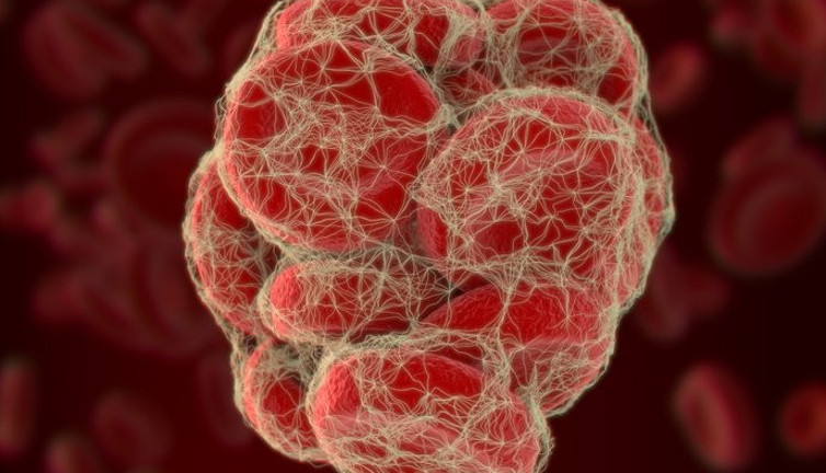 Bu belirtilere dikkat. Ölümcül olabilir