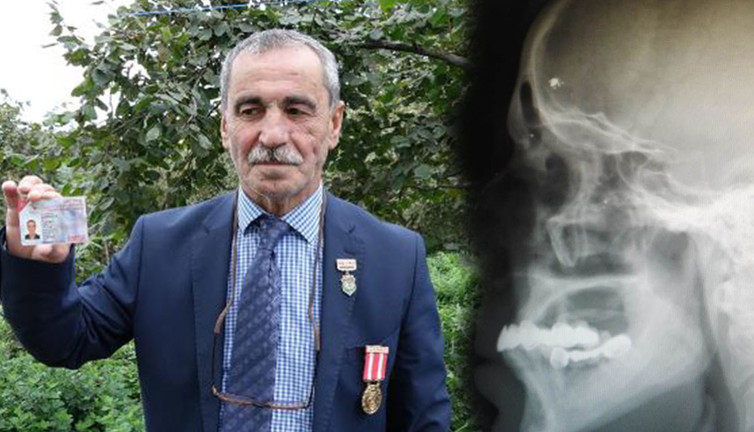 Büyük çatışmadan 43 yıl sonra ortaya çıktı