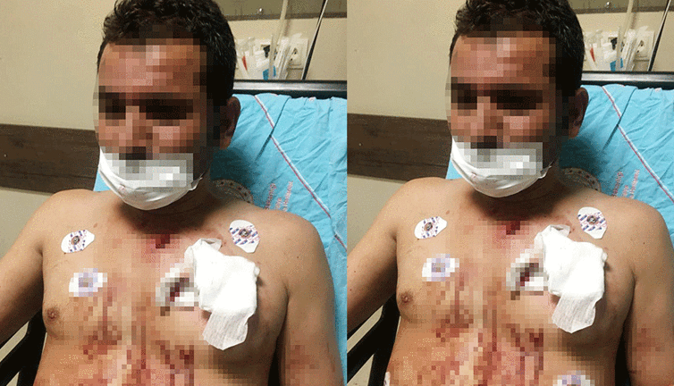 Eve gizlice girip sevgilisini bıçakladı