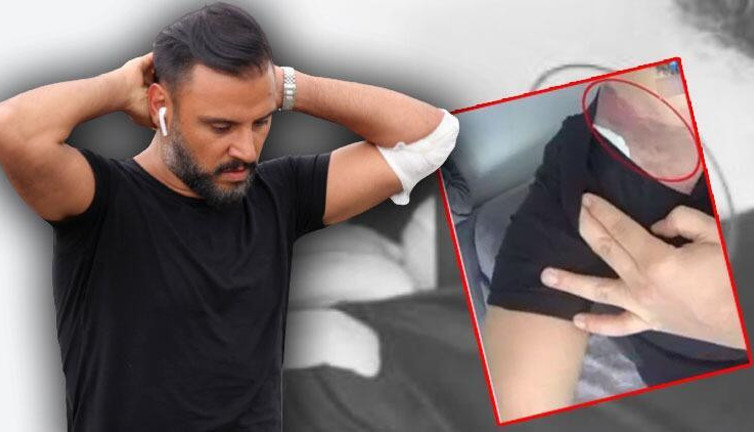 Tişörtle denize giren Alişan 2 milyonluk dava açtı