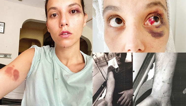 Ozan Güven ve Deniz Bulutsuz'un darp davasında tanıklar çelişkili ifade verdi