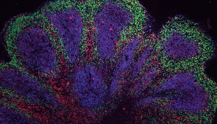Bilim insanları mini beyin geliştirdi. Tıp dünyasında çığır açacak gelişme