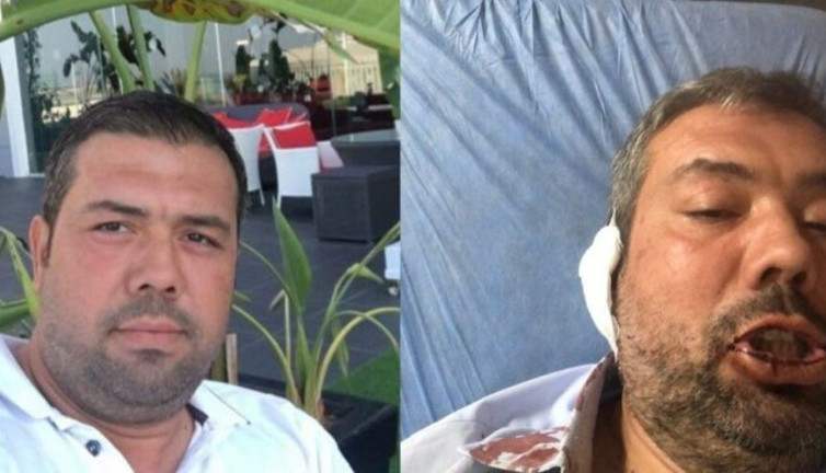 MHP’li belediye aleyhine paylaşım yapan mühendise saldırı, O anlar kamerada