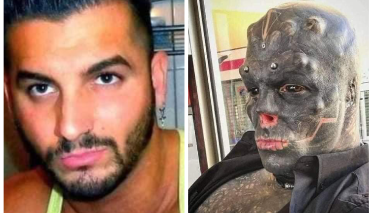 Cerrahlar bile emin misin diye defalarca sordu