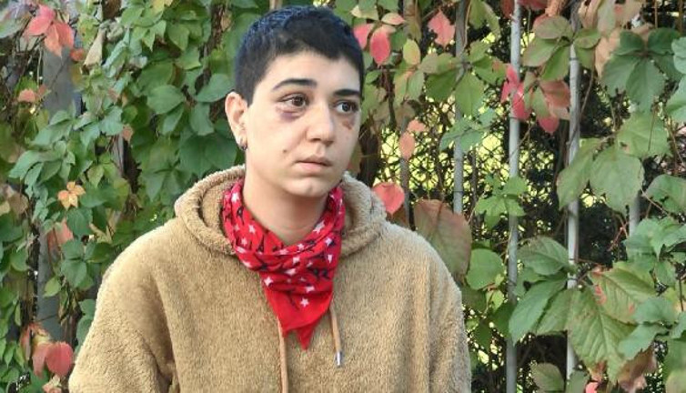 Yabancı uyruklu adam genç kızı felç edene kadar dövdü