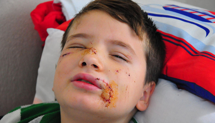 Sokak köpeği dehşeti. 8 yaşındaki çocuğa sokak köpekleri saldırdı