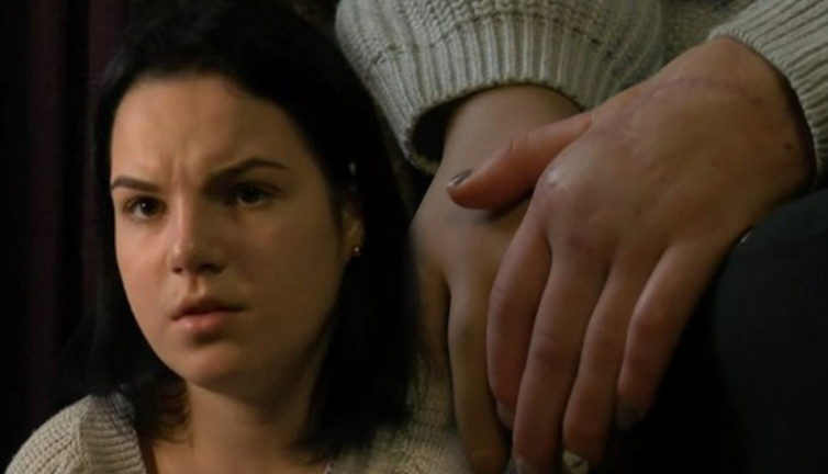 Cani koca baltayla ellerini kesmişti! Genç kadına rekor tazminat