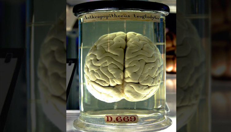 Beyin 1 litre su, 150 gram yağ, 15 gram şeker, 110 gram protein, 10 gram tuzdan ibarettir