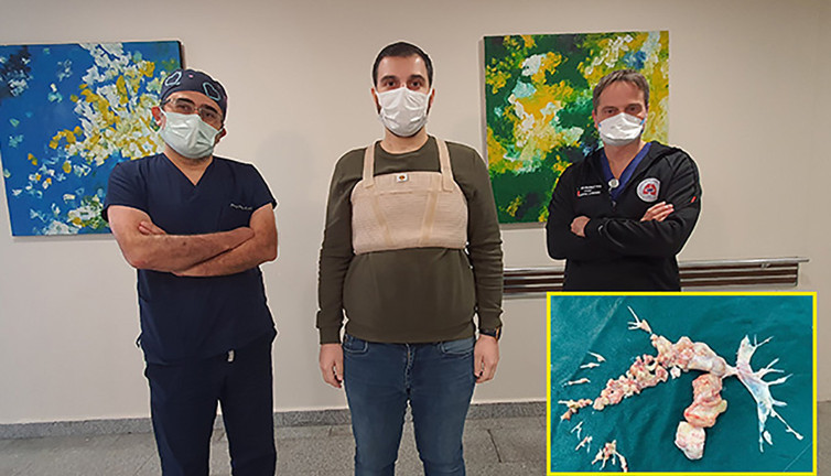 Ameliyatta ortaya çıkan gerçek doktorları bile şaşırttı. Dünya’da ilk vaka olarak literatüre girecek