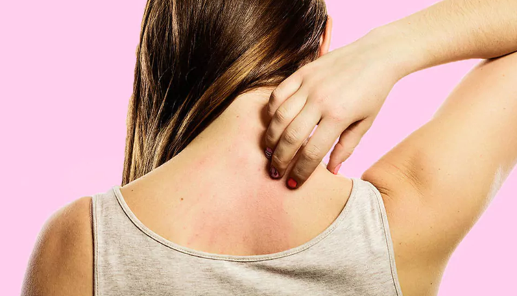 Kaşınmanın sebebini uzman isim açıkladı