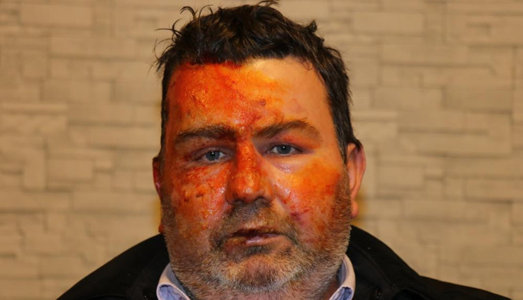 Derin uykuda dehşeti yaşadı diri diri yanarken uyandı